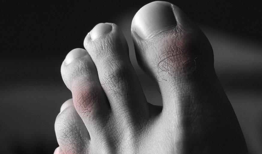 5 Common Shoe Mistakes that Cause Foot Pain